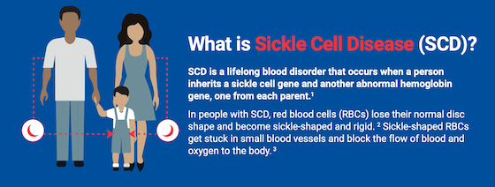 What is sickle cell disease?
